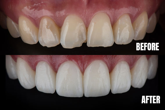 south oak dental before and after