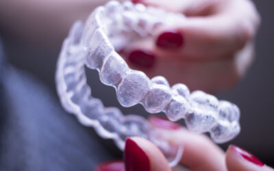 Getting Clear Aligners: What Affects the Cost of Straightening Teeth