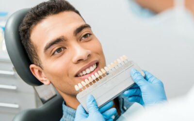 Teeth Whitening Longevity: Why Maintenance Matters