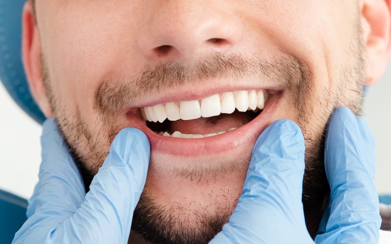 man having teeth examined at dentists