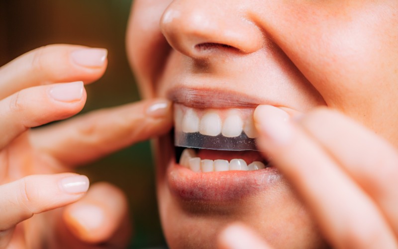 woman using whitening stipes whitestrips whitening teeth home