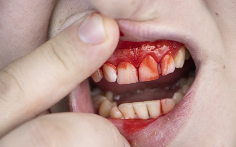 Identifying Dental Emergencies: When it’s Time to See Your Dentist