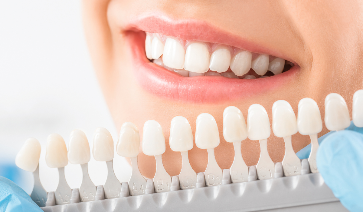 Dentist in South Oakville at South Oak Dental explaining teeth whitening treatment options